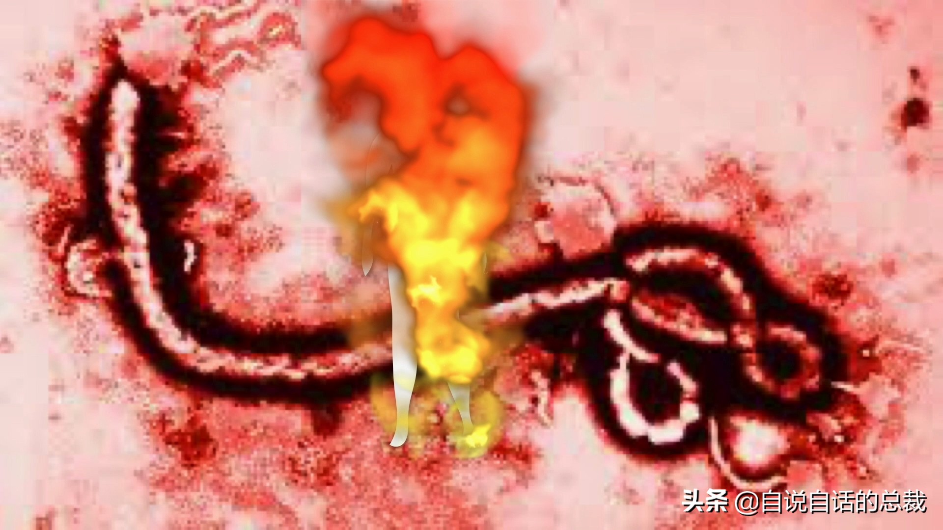 埃博拉：人类的诅咒，你的身体如何对抗它，它到底有多恐怖