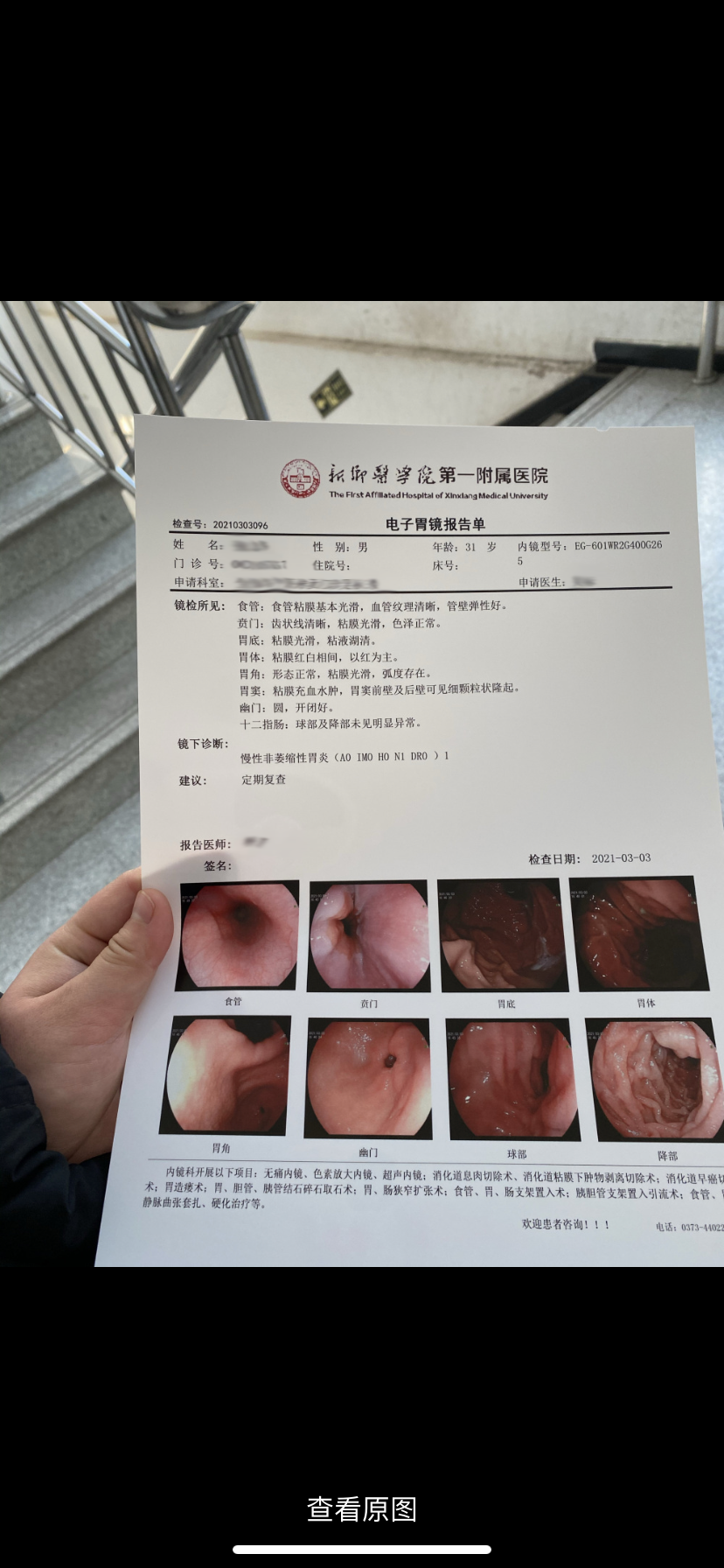 为了评估胃癌风险,医生在胃镜报告单后面留了一组"密码"