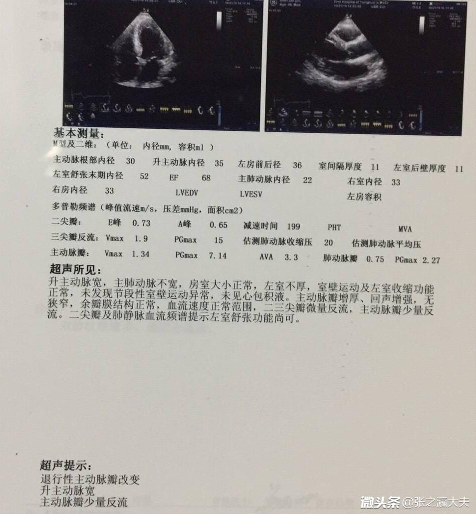 足球比赛突然倒地是为什么(欧洲杯晕倒球员埃里克森，最新病因分析！医生：此病可能性最大)