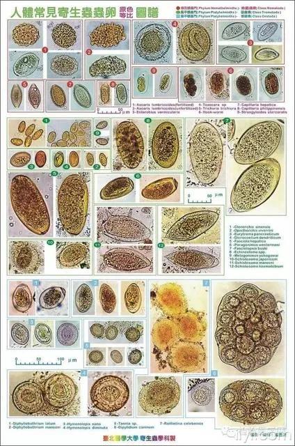 简单的大便常规检查有这么多奥妙,看看你了解多少呢?