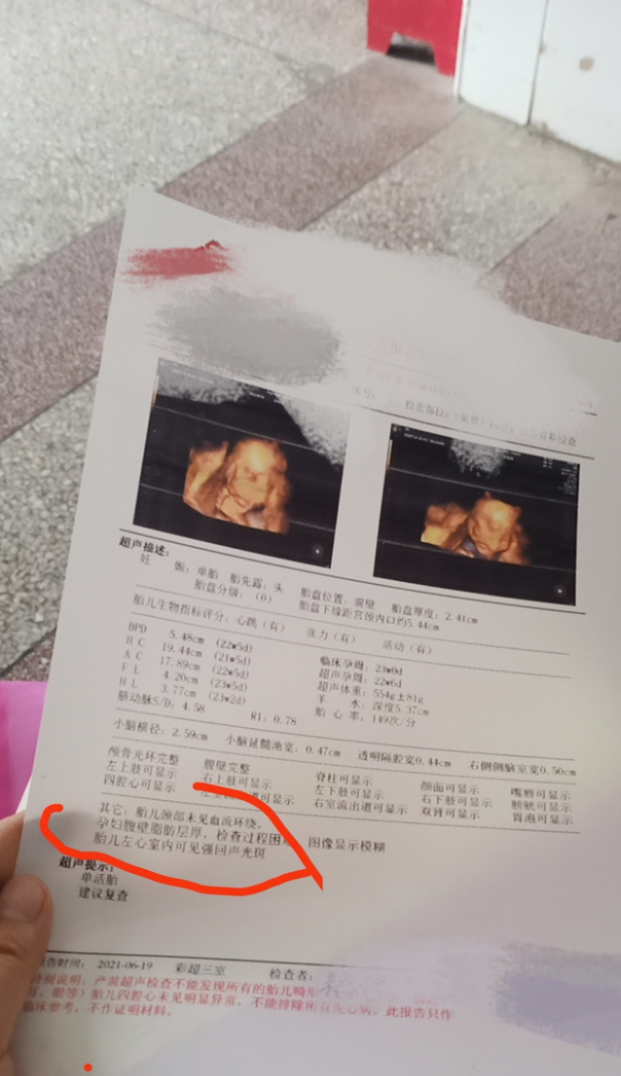 我的宝宝，我只想他能够平安地出生