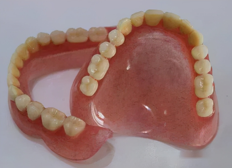 全口假牙指的是全口活动的假牙,这是比较传统的牙齿修复方式,活动假牙
