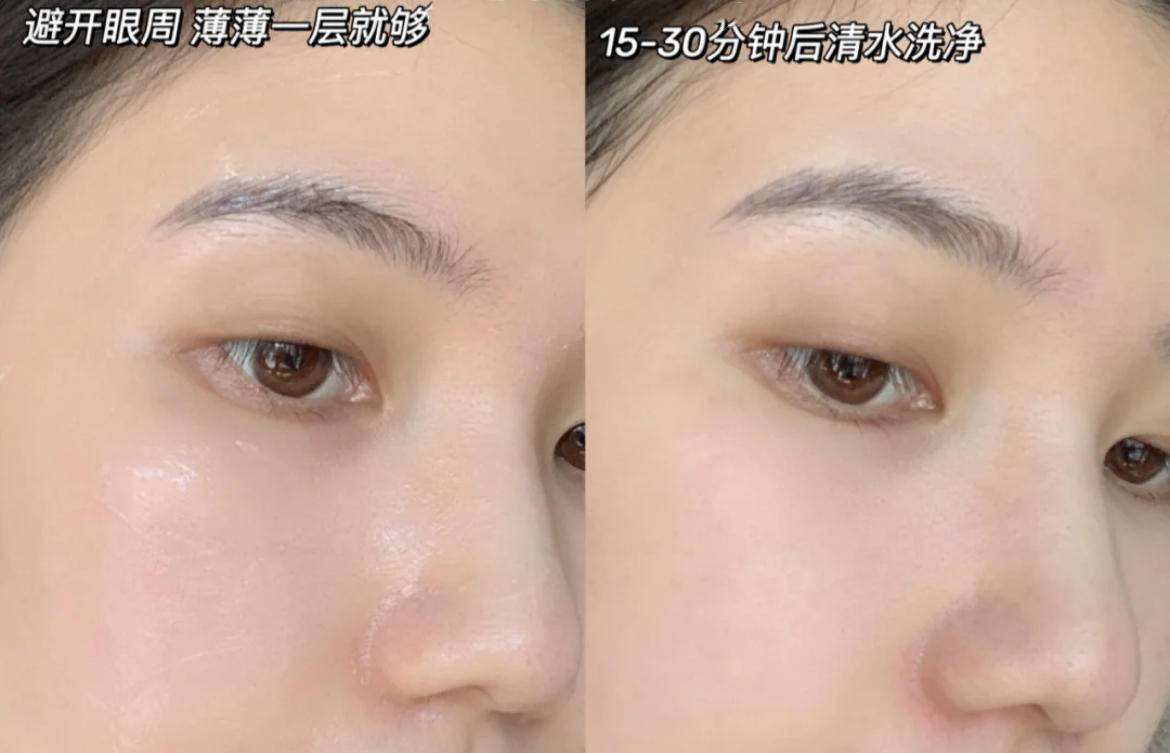 0颗粒0粗糙，今天把脸上小疙瘩解决掉