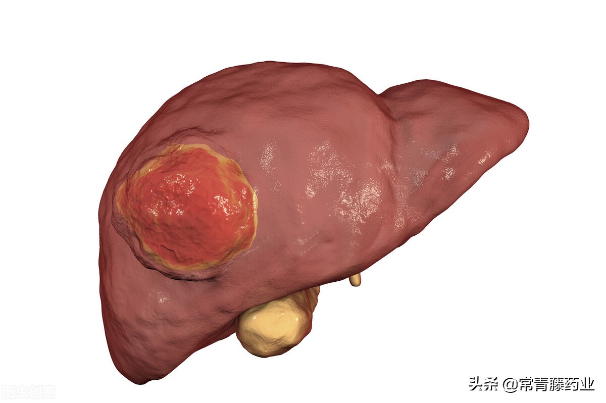 出生后2-3月甲胎蛋白基本被白蛋白替代,血液中较难检出,故在成人血清