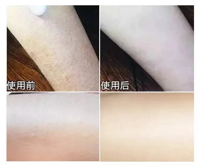 冬天一到，身体就干燥起皮？护肤达人教你一招，只需抹一下就好了