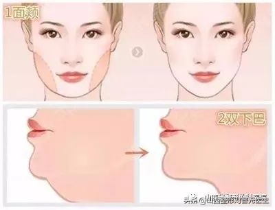 面部吸脂手术，你知道多少秘密？