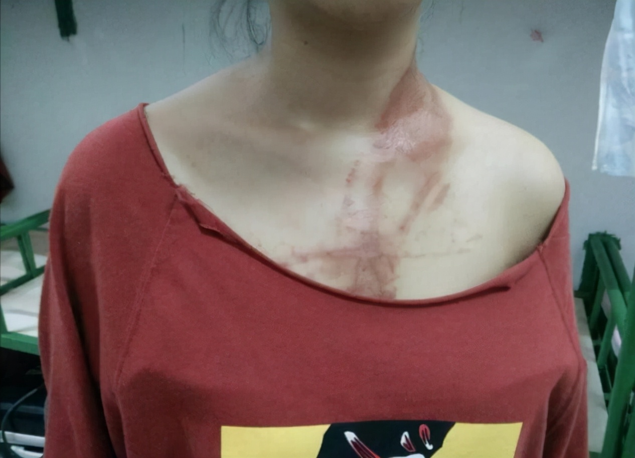 隱翅蟲主要分布在哪里,隱翅蟲主要分布在哪里 中國隱翅蟲分布地區