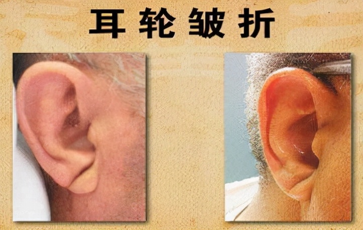胸痛就是冠心病吗？三步自查，教你辨别是不是得了冠心病？