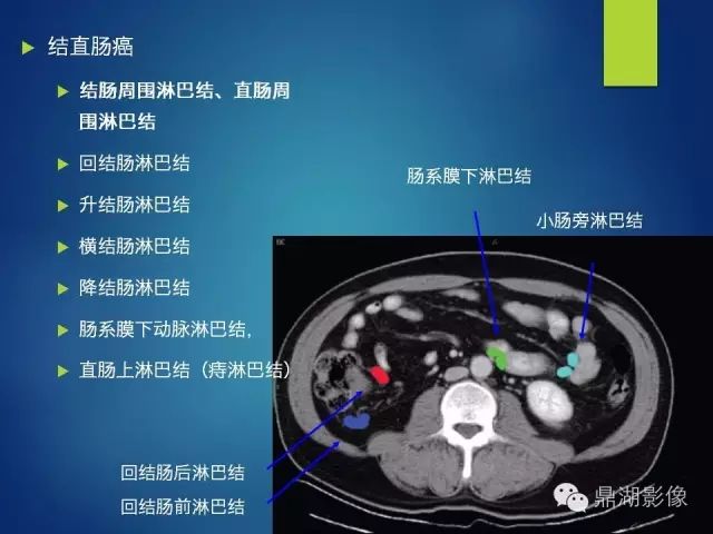 腹部淋巴结腹部淋巴结发炎引起腹痛如何缓解