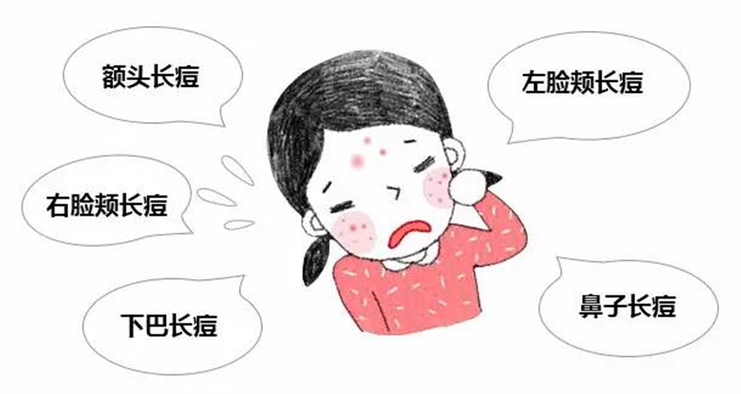 脸部老爱长痘怎么办？坚持做好这几个方法，还你干净的面容