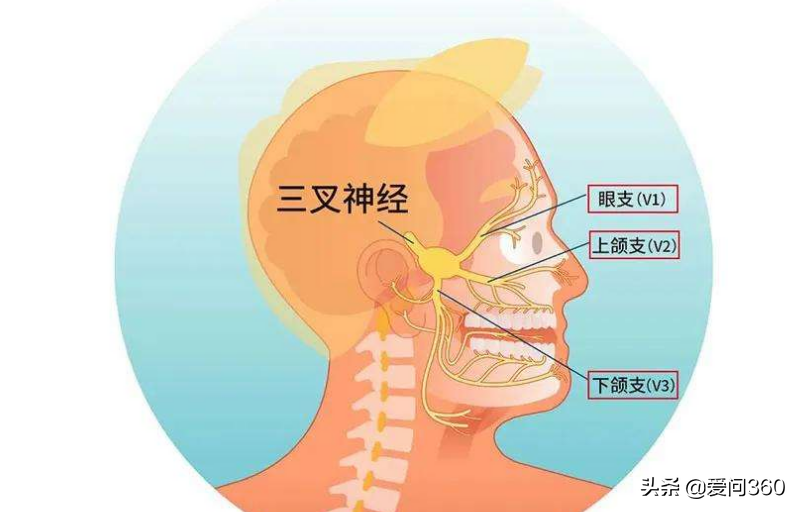 三叉神经痛实在太疼，这些原因要知道，如何缓解？