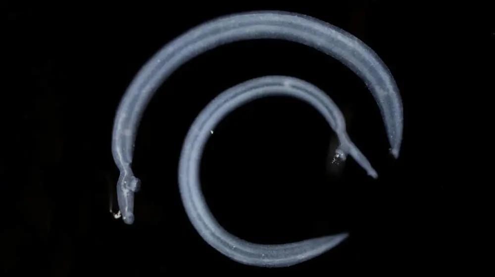 其发病机制涉及:慢性失血如钩虫成虫寄生于小肠, 藉口囊内的钩齿或板