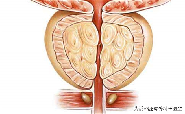 肛门潮湿瘙痒，是湿气重吗？有这3种病因，处理不及时后果严重