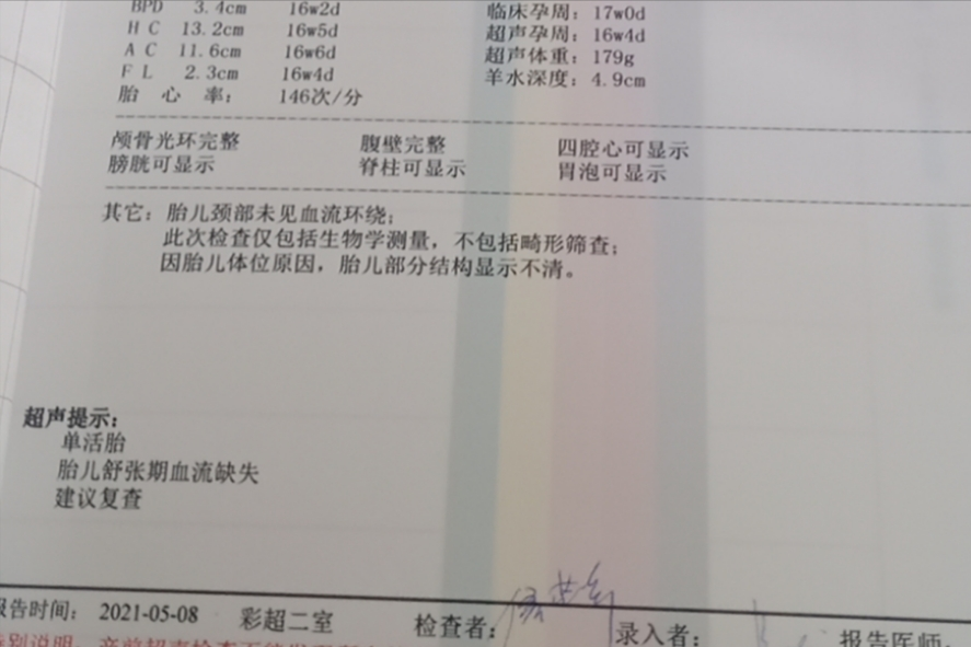 我的宝宝，我只想他能够平安地出生
