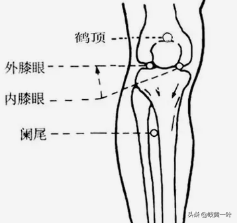 关节炎的辩证针灸，风寒湿痹的辩证论治。