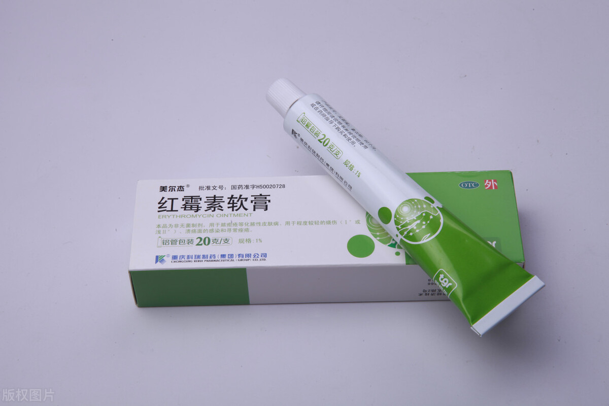 红霉素软膏的作用(几块钱的红霉素软膏) - 行就行