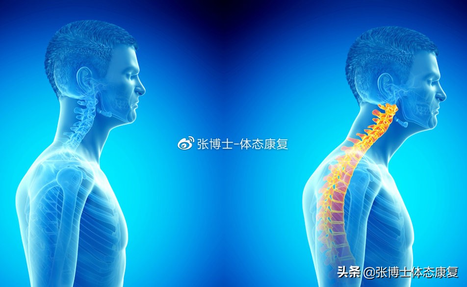 体态康复：有效缓解脖子疼痛的科学方法