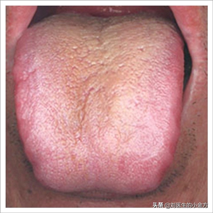 《中医舌诊》,9大体质舌诊图,看看你属于哪种?