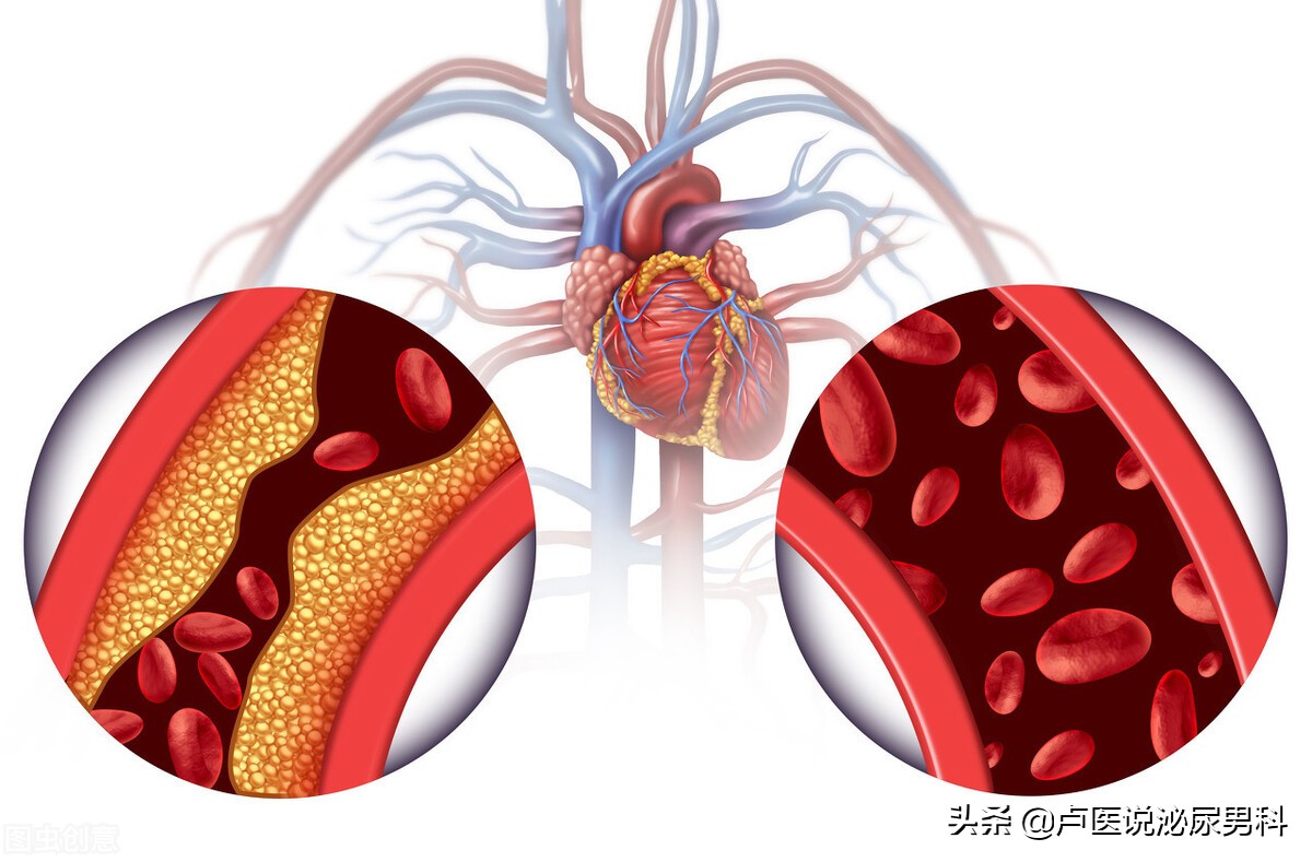 男性患有心血管疾病合并阳痿,补充叶酸有什么作用,本文为你分析