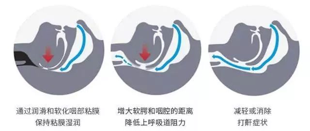又打呼噜了？老博士教你一妙招，只需喷一下，就能安静睡到天亮