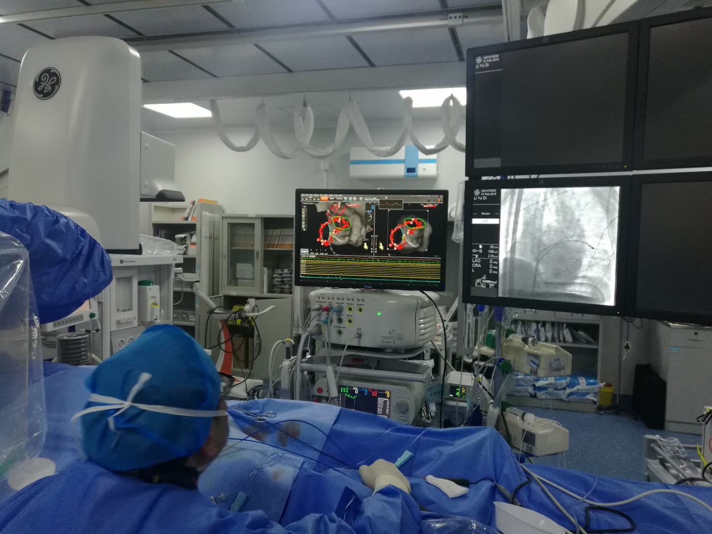 什么是房颤？哪种治疗方法最好？