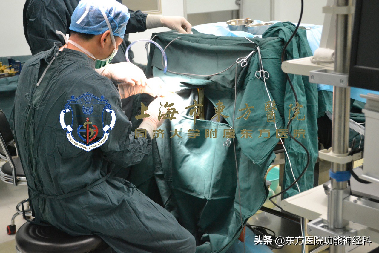 镇宁5.28事件后，手术治愈精神分裂暴戾狂人。（刀光剑影，生死瞬间）