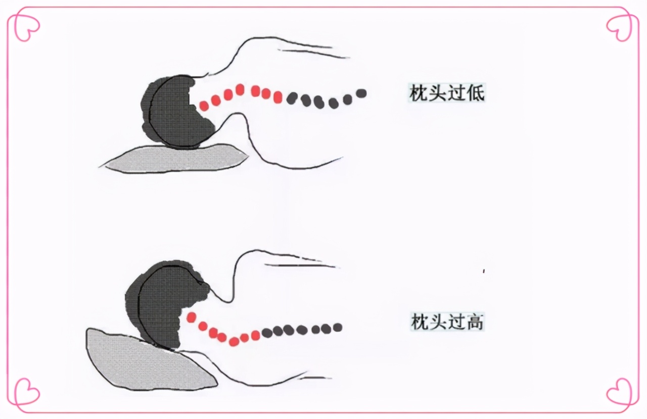 3个月的宝宝能用枕头？月龄和用枕方式有门道，“高枕”并不无忧