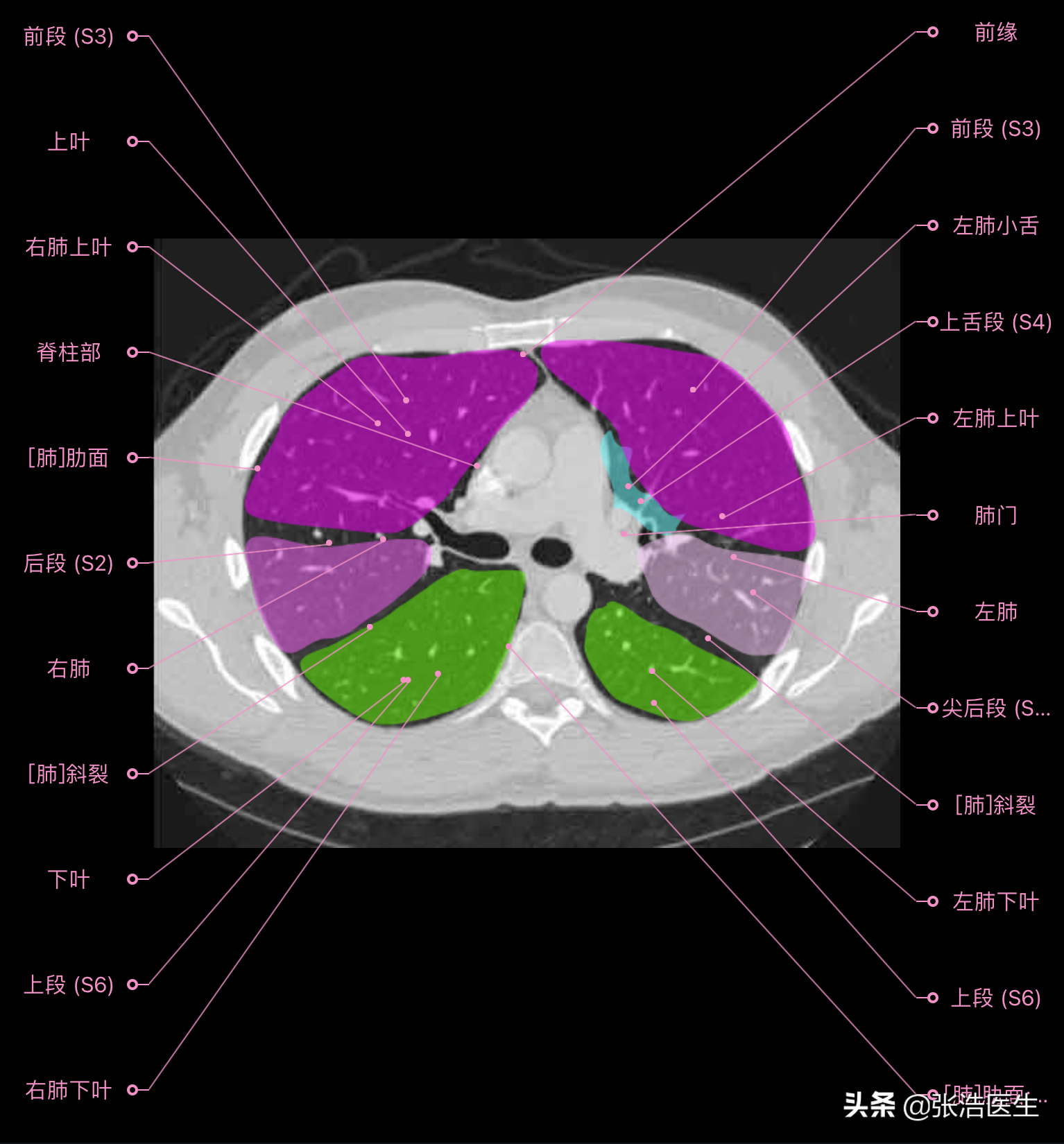 ct扫描定位线解剖图图片