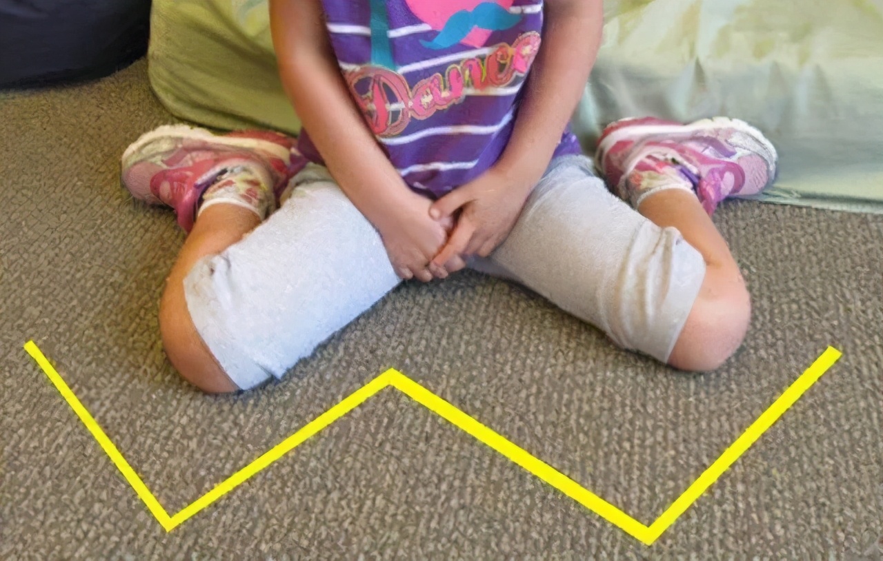 别急着拍照!这样的坐姿对宝贝并不好