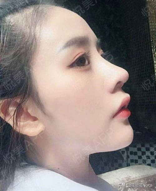 十种鼻型图片（图文讲解10种不同的鼻型）