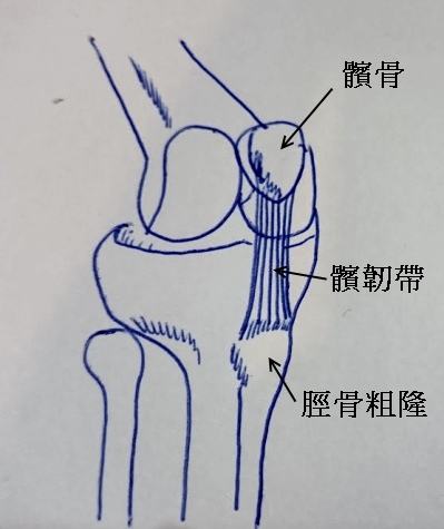 她3年蹲不下，走路一拐一瘸，上下楼痛，置换要花10万元……