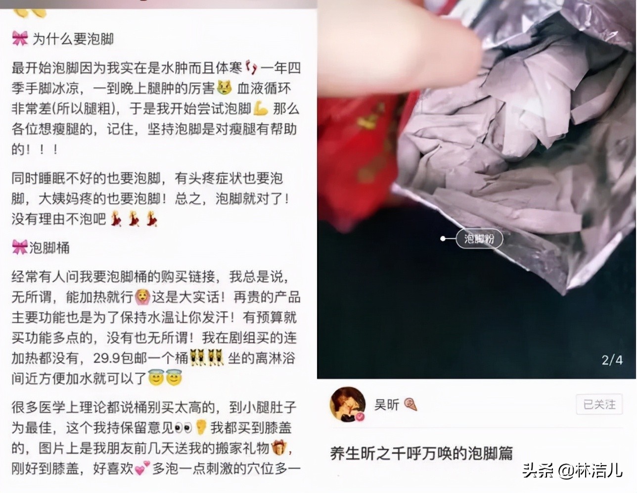 女明星瘦腿都是血泪史，韩国女团“懒人瘦腿法”，能让你月瘦5kg
