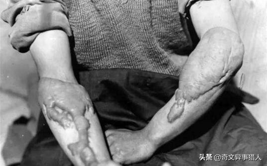 福岛核泄漏后变异女人