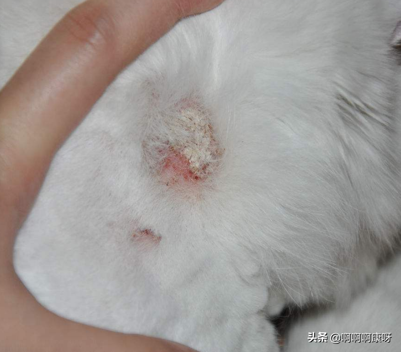怎么判断感染猫藓，猫藓又是什么，猫藓患者教你预防治疗的好办法