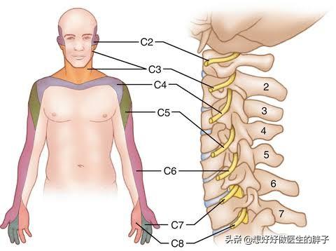 颈椎间盘突出或骨刺压迫神经会引起什么症状？如何治疗？如何康复