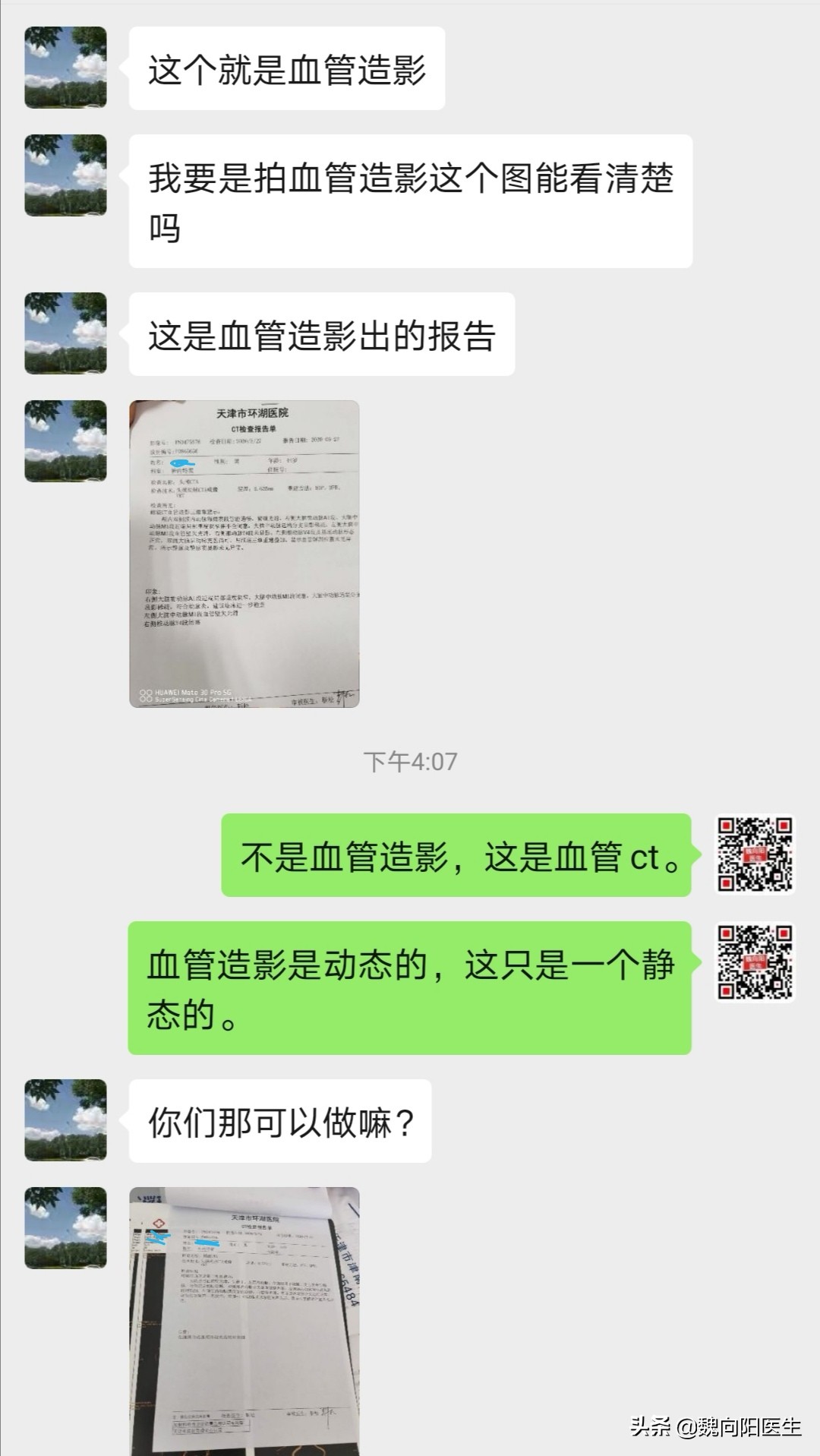 医生说的血管造影与患者认为的“血管造影”是一个检查吗？