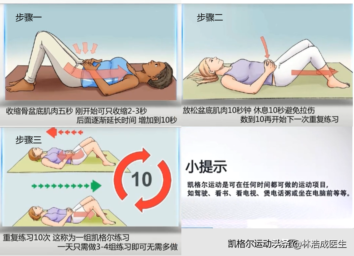 提高性功能的锻炼方法——凯格尔运动