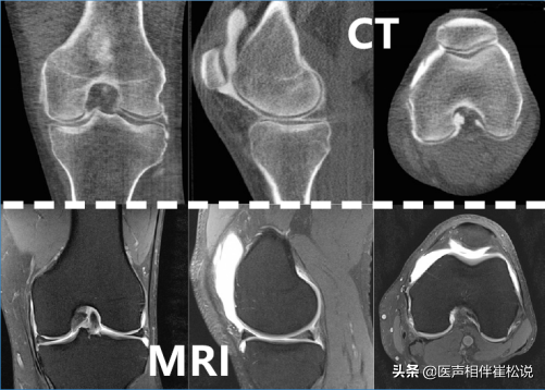 得了病，到底做哪种检查好？X片、CT还是磁共振？