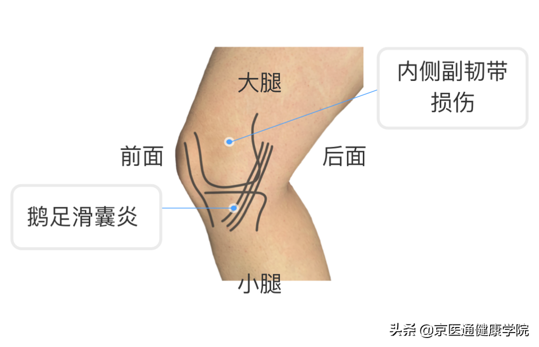 膝盖疼是什么病？积水潭专家教你1个动作判断