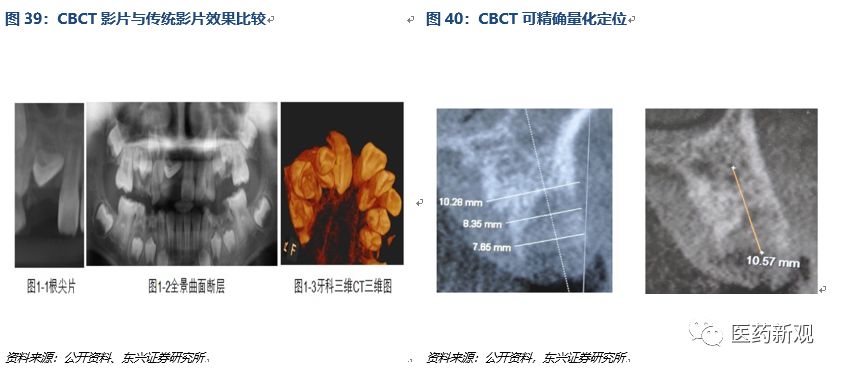 种植牙行业报告：核心技术国外垄断，每颗种植牙成本2000卖1万