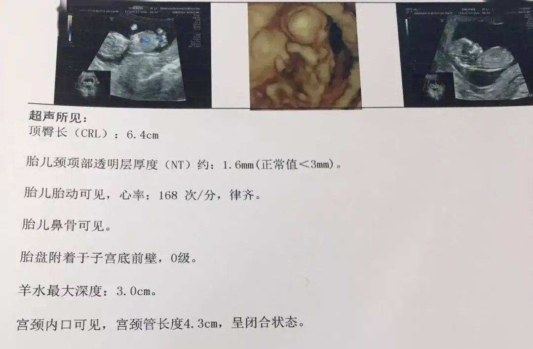 孕12周，16周，20周三次孕检非常重要，若不过关，胎儿很难保住