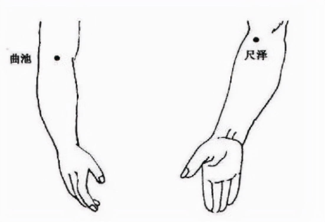 “天下第一痛”，中医也有招