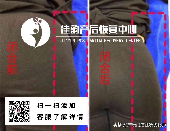 三線城市產后恢復加盟多少錢「佳韻產后恢復」