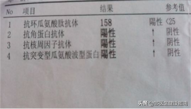 手指肿痛僵硬、有结节，预示着哪些疾病？