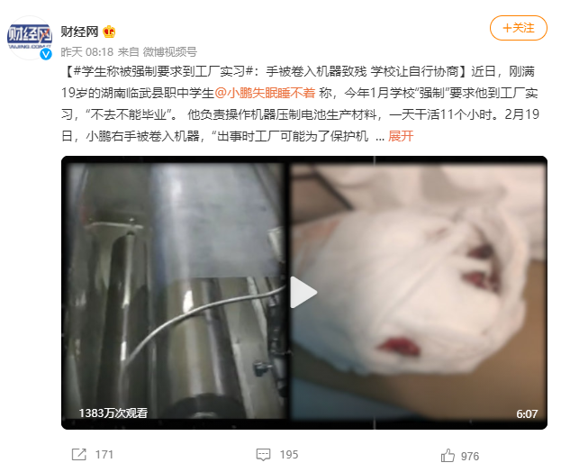 大学生因为在工厂实习，右手被卷入机器致残！大学生医保很重要