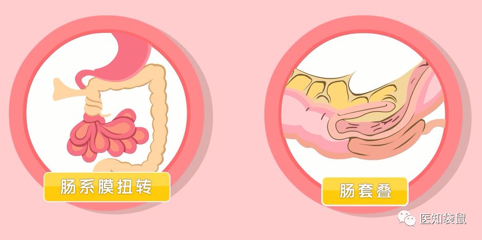 宝宝便秘、腹泻、消化不好，益生菌别乱吃！补之前这项检查做了吗