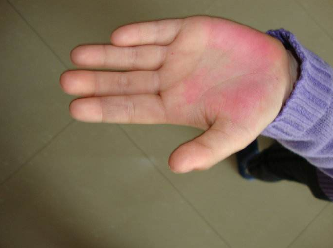 先生的戒尺打手心图片(小学老师用戒尺打学生手心) - 赤虎壹号