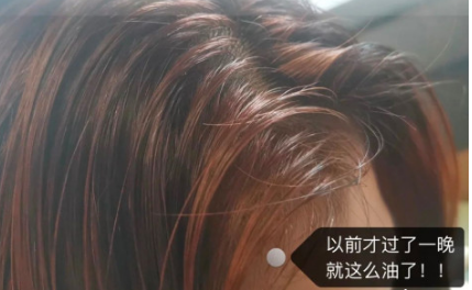 洗发水黑名单大吐槽，各个都是“脱发神器”, 难怪发际线上移
