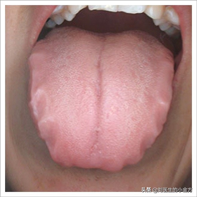 《中医舌诊》,9大体质舌诊图,看看你属于哪种?