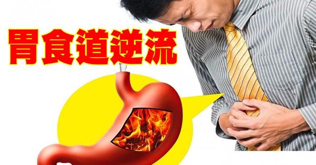经常烧心、吐酸水消化不好？胃食道逆流影响大，4类药物有助改善